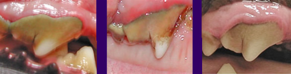 stage 3 dental disease